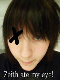 Zeith ate my eye!