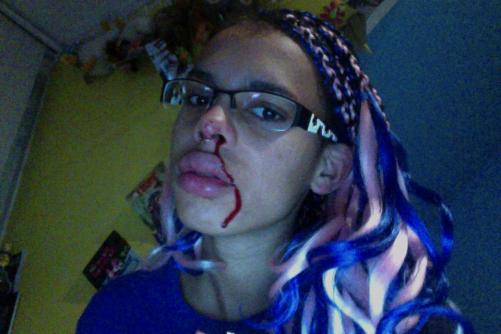 omdat bloedneuzen mooi zijn